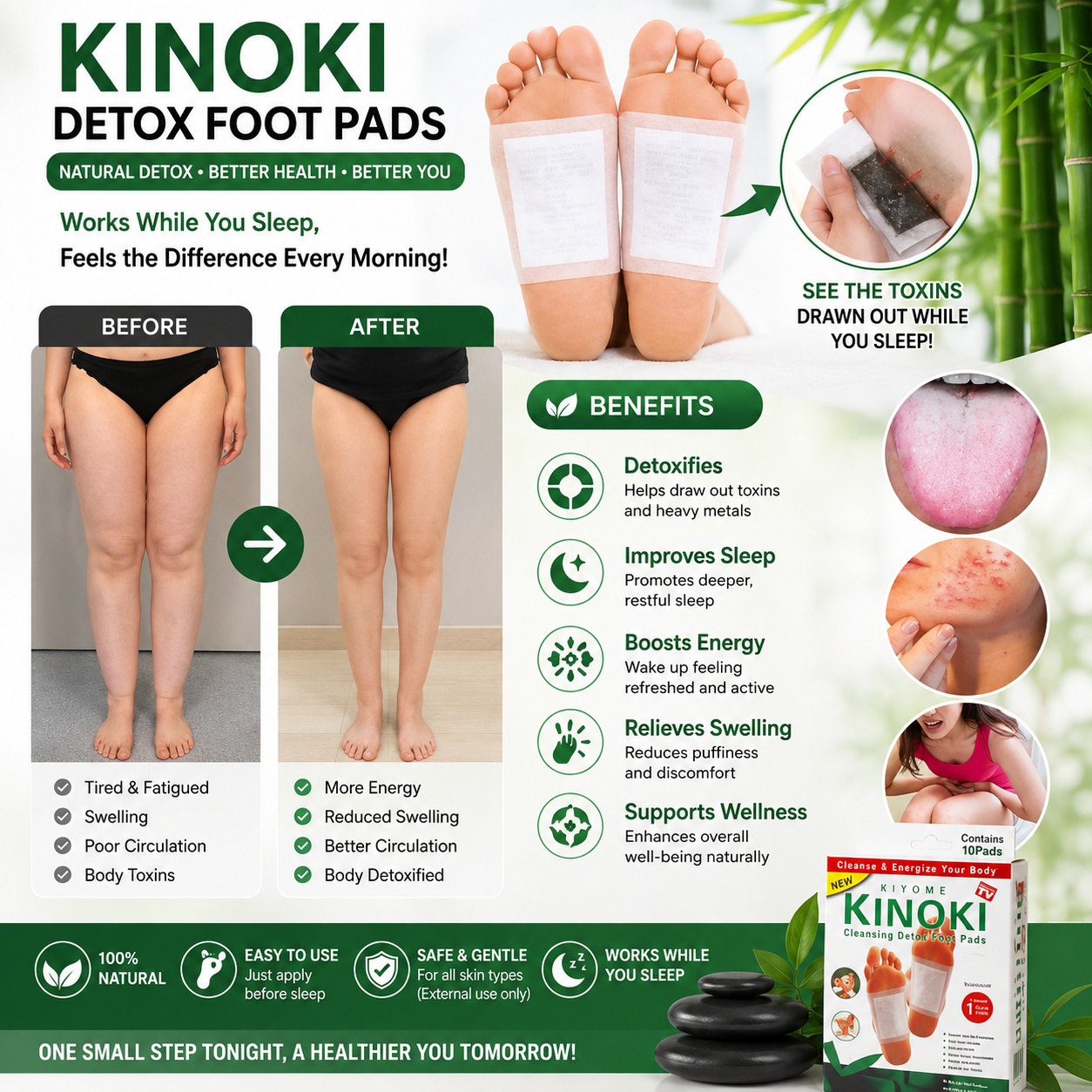 Kinoki Bamboo Detox Foot Patches – Natural Toxin Removal Foot Pads for Better Sleep, Foot Care & Body Wellness (10 PCS)